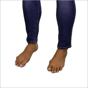 Tardive dyskinesia movement in lower limbs Involuntary lower limbs movement, video