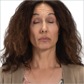 Tardive dyskinesia movement in eyes Involuntary eyes movement, video