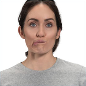 Woman with TD facing forward with her top and bottom lips puckering and pursing
