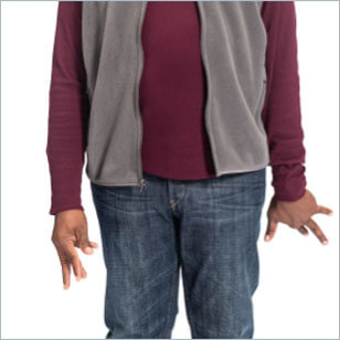 Tardive dyskinesia movement in upper limbs Involuntary upper limbs movement, video